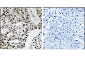 Immunohistochemistry (IHC) image for anti-Zinc Finger, MYM-Type 4 (ZMYM4) (AA 801-850) antibody (ABIN1535476)