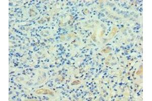 Immunohistochemistry of paraffin-embedded human kidney tissue using ABIN7164230 at dilution of 1:100 (PSG1 抗体  (AA 180-419))