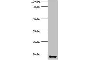 Western blot All lanes: Calmodulin-like protein 5 antibody at 12 μg/mL + A431 whole cell lysate Secondary Goat polyclonal to rabbit IgG at 1/10000 dilution Predicted band size: 16 kDa Observed band size: 16 kDa