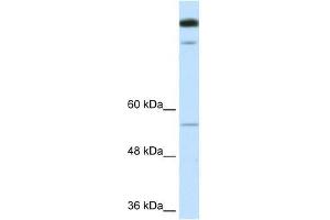 TIMELESS antibody used at 1. (TIMELESS 抗体  (N-Term))