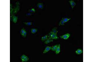 Immunofluorescent analysis of HepG2 cells using ABIN7158953 at dilution of 1:100 and Alexa Fluor 488-congugated AffiniPure Goat Anti-Rabbit IgG(H+L) (MLYCD 抗体  (AA 40-493))