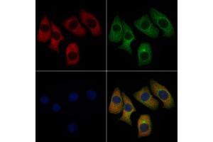 ABIN6261636 and ABIN6276681 staining Hela cells by IF/ICC.