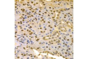 Immunohistochemistry of paraffin-embedded rat kidney using COPS5 antibody at dilution of 1:100 (x400 lens). (COPS5 抗体)