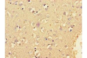 Immunohistochemistry of paraffin-embedded human brain tissue using ABIN7157745 at dilution of 1:100 (KCNIP4 抗体  (AA 1-250))