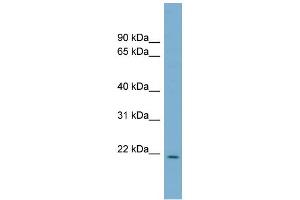 WB Suggested Anti-CUTA Antibody Titration:  0. (CUTA 抗体  (Middle Region))