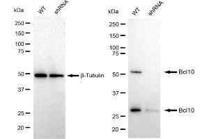 Western blotting analysis using Bcl10 antibody (ABIN7797717). (Recombinant BCL10 抗体)