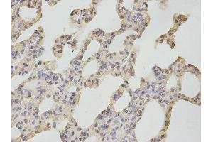 Immunohistochemistry (IHC) image for anti-Calcium/calmodulin-Dependent Protein Kinase IV (CAMK4) antibody (ABIN1876492) (CAMK4 抗体)