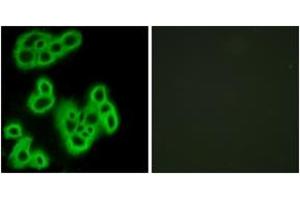 Immunofluorescence analysis of MCF7 cells, using FPR1 Antibody. (FPR1 抗体  (AA 155-204))