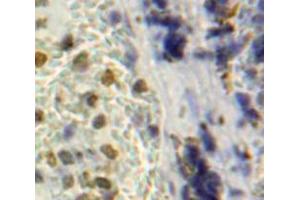 Used in DAB staining on fromalin fixed paraffin-embedded Spleen tissue (NUP160 抗体  (AA 1211-1436))