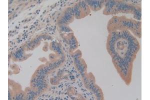 Detection of AIMP1 in Mouse Uterus Tissue using Polyclonal Antibody to Aminoacyl tRNA Synthetase Complex Interacting Multifunctional Protein 1 (AIMP1)