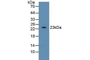 Figure. (SDF2 抗体  (AA 19-211))