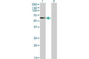 Western Blot analysis of STK33 expression in transfected 293T cell line by STK33 monoclonal antibody (M02), clone 6G1. (STK33 抗体  (AA 1-514))