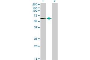 Western Blot analysis of STK33 expression in transfected 293T cell line by STK33 monoclonal antibody (M02), clone 6G1.