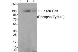 Western blot analysis of extracts from K562 cells (Lane 2) and 3T3 cells (Lane 3), using P130 Cas(Phospho-Tyr410) Antibody. (BCAR1 抗体  (pTyr410))