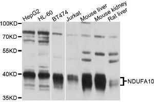 Western blot analysis of extracts of various cell lines, using NDUFA10 antibody (ABIN6003821) at 1/1000 dilution. (NDUFA10 抗体)