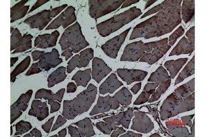 Immunohistochemistry (IHC) image for anti-Actin, Alpha, Cardiac Muscle 1 (ACTC1) (N-Term) antibody (ABIN3180981)