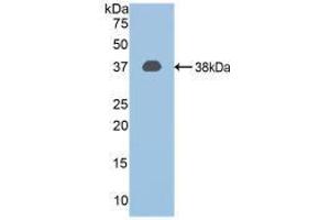 Western Blotting (WB) image for anti-Calpain 1, Large Subunit (CAPNL1) (AA 387-694) antibody (ABIN2901957)