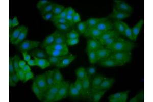Immunofluorescence staining of HepG2 cells with ABIN7167158 at 1:166, counter-stained with DAPI. (IQGAP2 抗体  (AA 1245-1395))