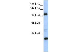 Western Blot showing TUT1 antibody used at a concentration of 1-2 ug/ml to detect its target protein. (TUT1 抗体  (Middle Region))