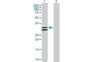 Western Blotting (WB) image for anti-Nudix (Nucleoside Diphosphate Linked Moiety X)-Type Motif 6 (NUDT6) (AA 1-316) antibody (ABIN524588)