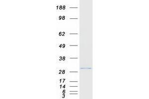 Western Blotting (WB) image for Signal Recognition Particle Receptor, B Subunit (SRPRB) protein (Myc-DYKDDDDK Tag) (ABIN2732655)