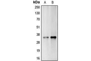 Western blot analysis of Carbonic Anhydrase 14 expression in A375 (A), Jurkat (B) whole cell lysates. (CA14 抗体  (Center))