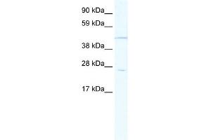 WB Suggested Anti-HOXB13 Antibody Titration:  1. (HOXB13 抗体  (Middle Region))
