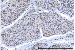 IHC analysis of RBM15B using anti-RBM15B antibody (ABIN7600219). (RBM15B 抗体  (AA 164-890))