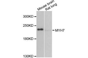 Western blot analysis of extracts of various cell lines, using MYH7 antibody (ABIN2563999) at 1:1000 dilution. (MYH7 抗体)