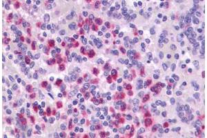 Anti-P2RY4 / P2Y4 antibody  ABIN1049219 IHC staining of human spleen.