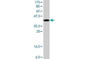Western Blot detection against Immunogen (37. (Ephrin B2 抗体  (AA 28-127))