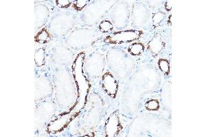 Immunohistochemistry (IHC) image for anti-Hexokinase 1 (HK1) (AA 20-300) antibody (ABIN3021309)