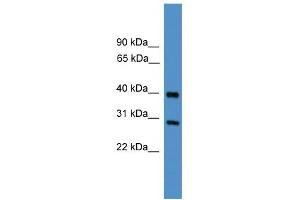WB Suggested Anti-TIMP2 Antibody Titration: 0. (TIMP2 抗体  (Middle Region))