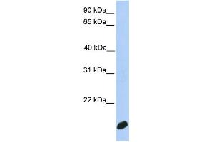 WB Suggested Anti-DSTN Antibody Titration:  0. (Destrin 抗体  (N-Term))