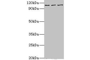 Western blot All lanes: MERTK antibody at 10 μg/mL Lane 1: Mouse gonad tissue Lane 2: Mouse lung tissue Lane 3: Mouse kidney tissue Secondary Goat polyclonal to rabbit IgG at 1/10000 dilution Predicted band size: 110 kDa Observed band size: 110 kDa (MERTK 抗体  (AA 840-999))