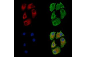ABIN7093395 and ABIN7097416 staining Hela cells by IF/ICC.