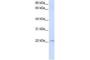 TMEM9 antibody used at 1 ug/ml to detect target protein. (TMEM9 抗体  (C-Term))