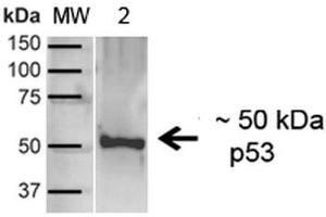 Western blot analysis of Human A431 showing detection of ~43. (p53 抗体  (C-Term) (FITC))