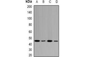 Western blot analysis of Fumarylacetoacetase expression in HepG2 (A), MCF7 (B), mouse liver (C), rat kidney (D) whole cell lysates. (FAH 抗体)