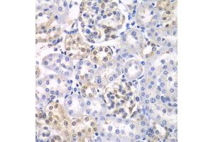 Immunohistochemistry of paraffin-embedded rat kidney using HDAC2 antibody. (HDAC2 抗体)