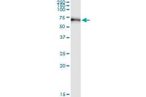 Immunoprecipitation of RIOK3 transfected lysate using anti-RIOK3 MaxPab rabbit polyclonal antibody and Protein A Magnetic Bead , and immunoblotted with RIOK3 purified MaxPab mouse polyclonal antibody (B01P) . (RIOK3 抗体  (AA 1-519))