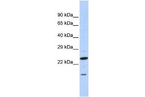 Western Blotting (WB) image for anti-Insulin Induced Gene 2 (INSIG2) antibody (ABIN2458474) (INSIG2 抗体)