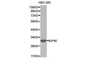 Western Blotting (WB) image for anti-Eukaryotic Translation Initiation Factor 4E (EIF4E) antibody (ABIN1872499) (EIF4E 抗体)