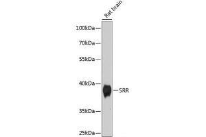 Western blot analysis of extracts of Rat brain using SRR Polyclonal Antibody at dilution of 1:1000.
