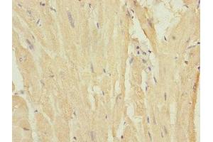 Immunohistochemistry of paraffin-embedded human heart tissue using ABIN7160546 at dilution of 1:100 (MYL7 抗体  (AA 1-175))
