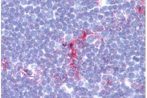 Human Thymus (formalin-fixed, paraffin-embedded) stained with CD1A antibody ABIN462117 at 1:100-1:200 followed by biotinylated goat anti-rabbit IgG secondary antibody ABIN481713, alkaline phosphatase-streptavidin and chromogen. (CD1a 抗体)