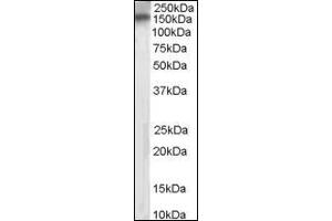 Image no. 1 for anti-Receptor Protein Tyrosine Phosphatase (PTPRT) (Internal Region) antibody (ABIN372866) (PTPRT 抗体  (Internal Region))