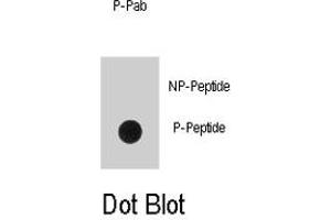 Dot blot analysis of EGFR (phospho Y1016) polyclonal antibody  on nitrocellulose membrane. (EGFR 抗体  (pTyr1016))
