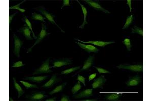 Immunofluorescence (IF) image for anti-Signal Transducer and Activator of Transcription 6, Interleukin-4 Induced (STAT6) (AA 694-801) antibody (ABIN520553)