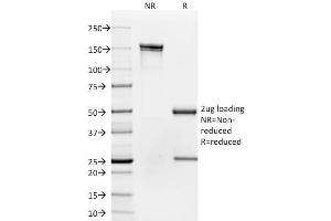 SDS-PAGE AnalysisPurified CD35 Mouse Monoclonal Antibody (To5). (CD35 抗体)
